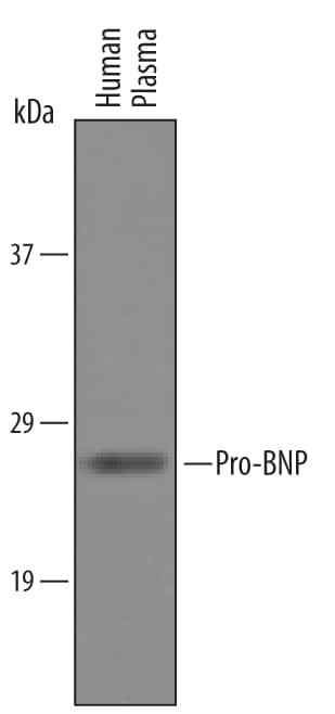 pro-Brain Natriuretic Peptide Antibody in Western Blot (WB)