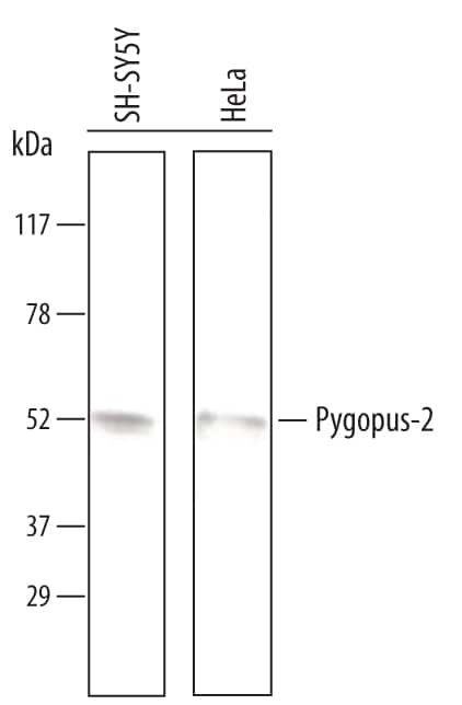PYGO2 Antibody in Western Blot (WB)