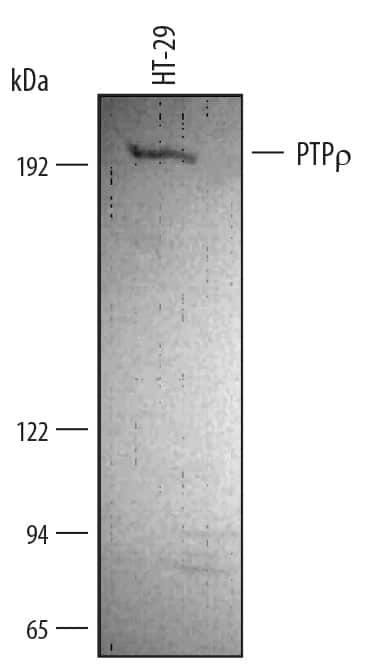 PTPRT Antibody in Western Blot (WB)