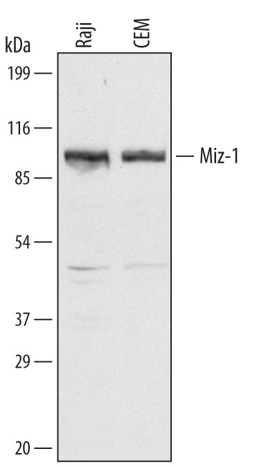 ZBTB17 Antibody in Western Blot (WB)