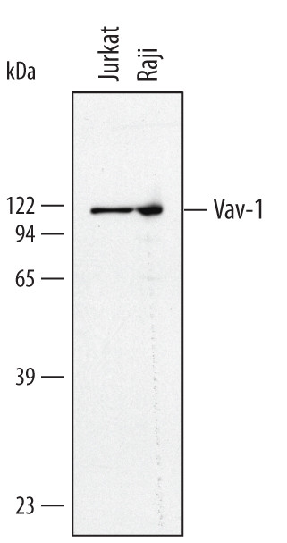 VAV1 Antibody in Western Blot (WB)
