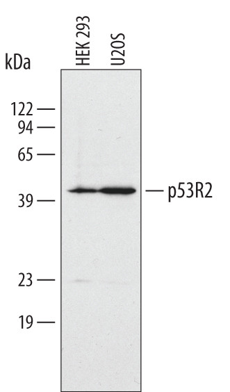 p53R2 Antibody in Western Blot (WB)