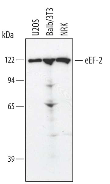 EEF2 Antibody in Western Blot (WB)