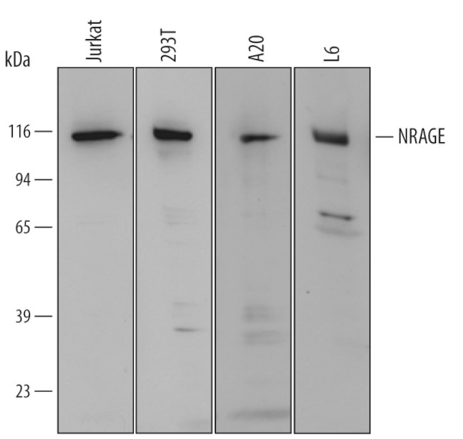 MAGED1 Antibody in Western Blot (WB)