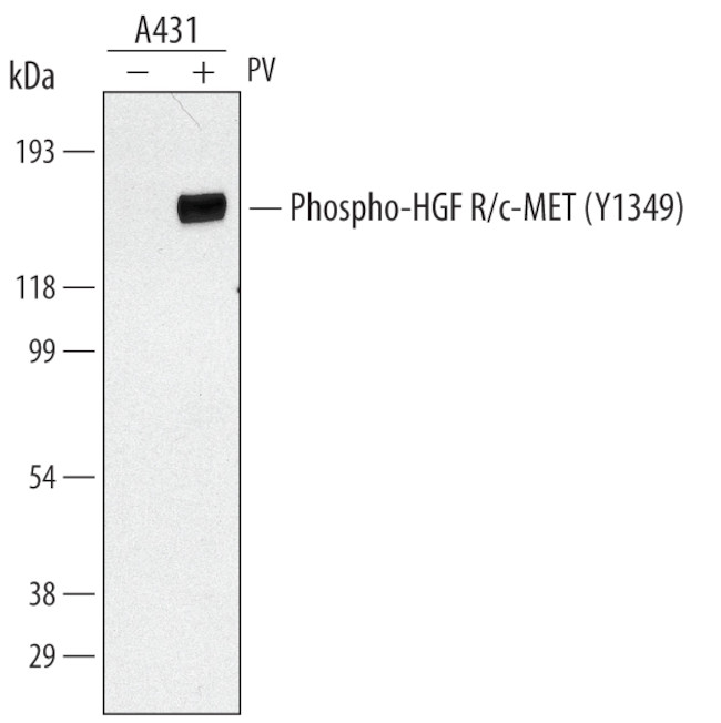Phospho-c-Met (Tyr1349) Antibody in Western Blot (WB)