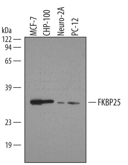FKBP25 Antibody in Western Blot (WB)