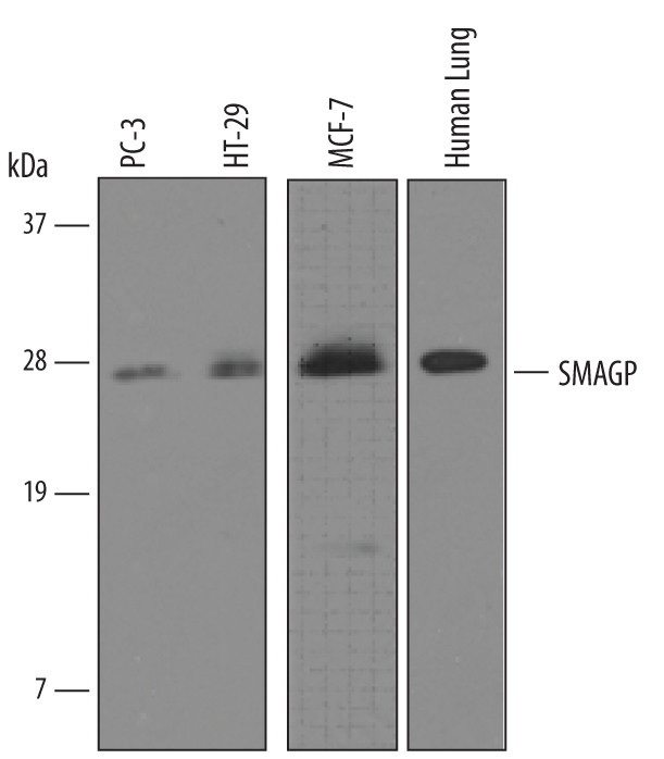 SMAGP Antibody in Western Blot (WB)