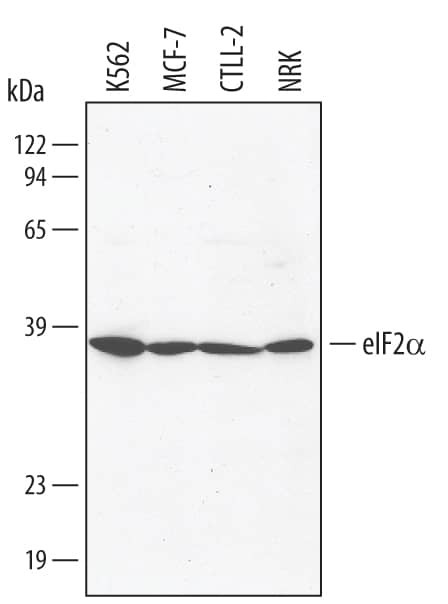 EIF2S1 Antibody in Western Blot (WB)
