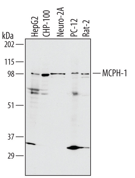 MCPH1 Antibody in Western Blot (WB)