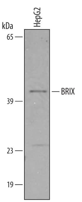 BXDC2 Antibody in Western Blot (WB)
