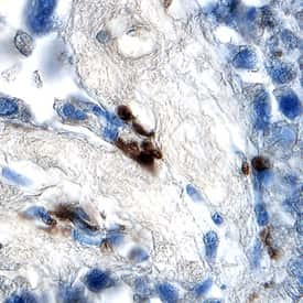 SMAD2 Antibody in Immunohistochemistry (Paraffin) (IHC (P))