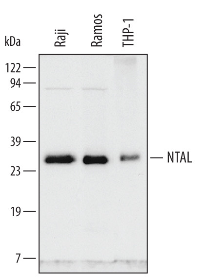 NTAL Antibody in Western Blot (WB)