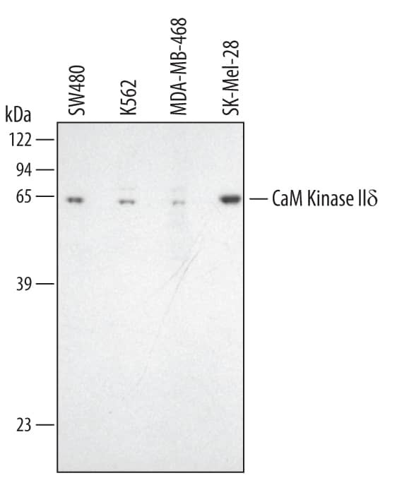 CaMKII delta Antibody in Western Blot (WB)