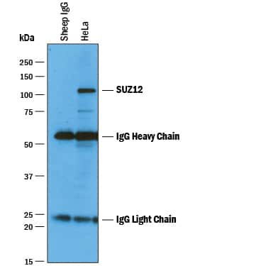 SUZ12 Antibody in Immunoprecipitation (IP)