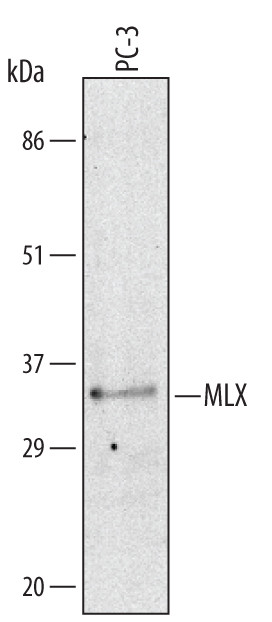 MLX Antibody in Western Blot (WB)