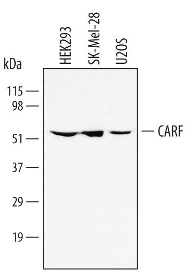 CARF Antibody in Western Blot (WB)