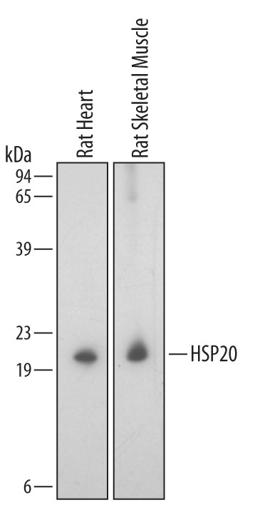 HSP20 Antibody in Western Blot (WB)