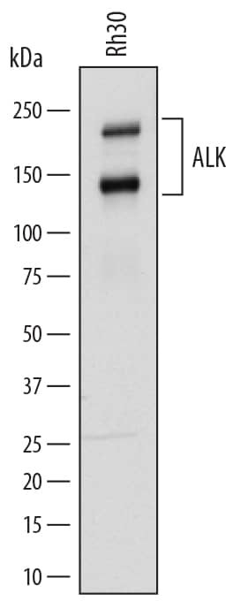 ALK Antibody in Western Blot (WB)