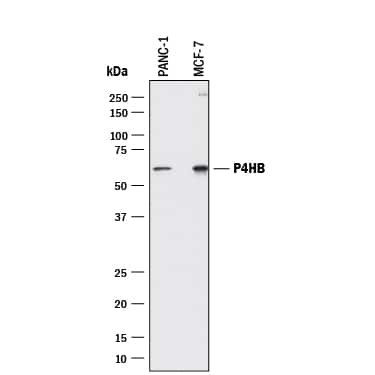 PDI Antibody in Western Blot (WB)