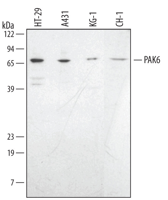 PAK6 Antibody in Western Blot (WB)