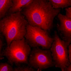 RAP Antibody in Immunocytochemistry (ICC/IF)