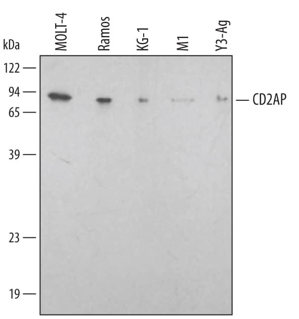 CD2AP Antibody in Western Blot (WB)