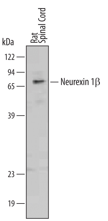 Neurexin 1 Beta Antibody in Western Blot (WB)