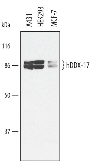 DDX17 Antibody in Western Blot (WB)