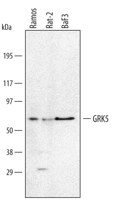 GRK5 Antibody in Western Blot (WB)