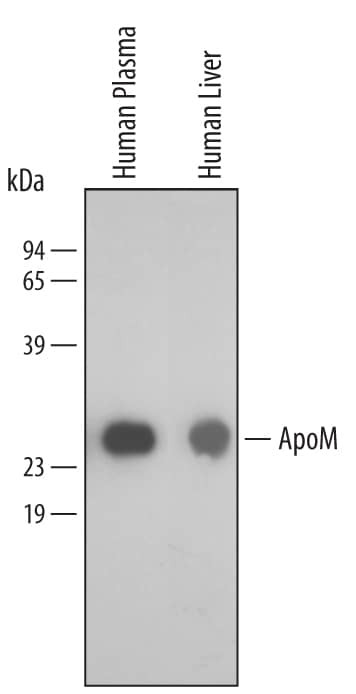 Apolipoprotein M Antibody in Western Blot (WB)