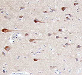 beta-Arrestin 2 Antibody in Immunohistochemistry (Paraffin) (IHC (P))