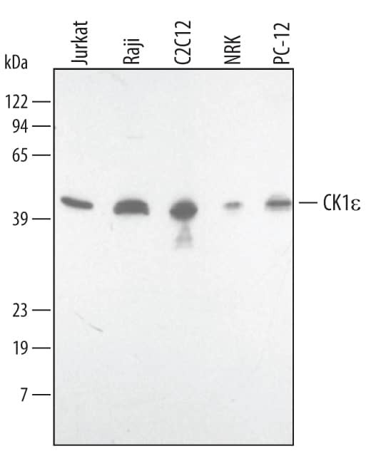 CK1 epsilon Antibody in Western Blot (WB)