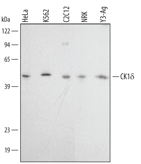 CK1 delta Antibody in Western Blot (WB)