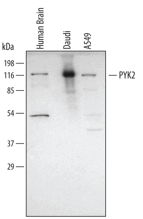 PYK2 Antibody in Western Blot (WB)