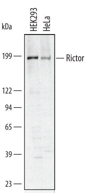 RICTOR Antibody in Western Blot (WB)
