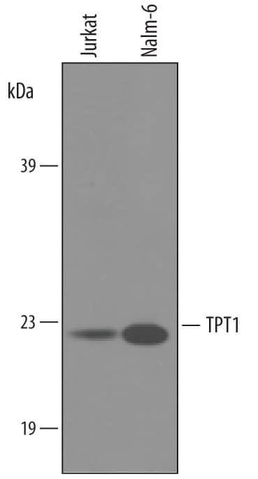TPT1 Antibody in Western Blot (WB)