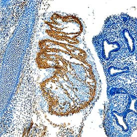 VEGFD Antibody in Immunohistochemistry (Paraffin) (IHC (P))
