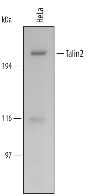Talin 2 Antibody in Western Blot (WB)
