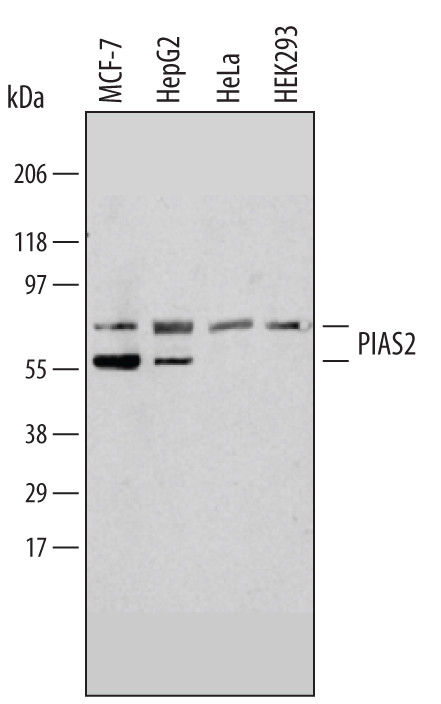 PIAS2 Antibody in Western Blot (WB)