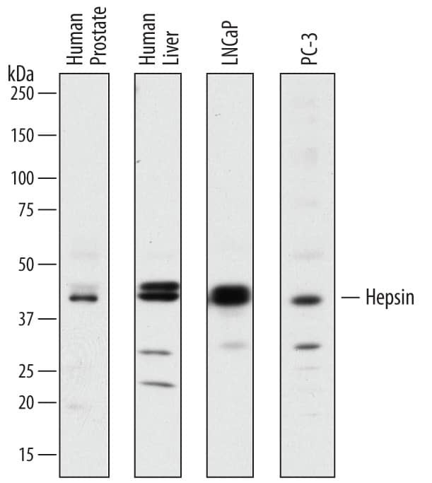 Hepsin Antibody in Western Blot (WB)