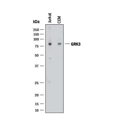 GRK3 Antibody in Western Blot (WB)