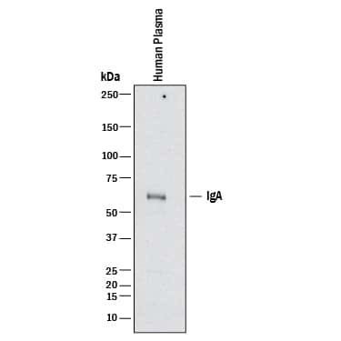 Human IgA Antibody in Western Blot (WB)