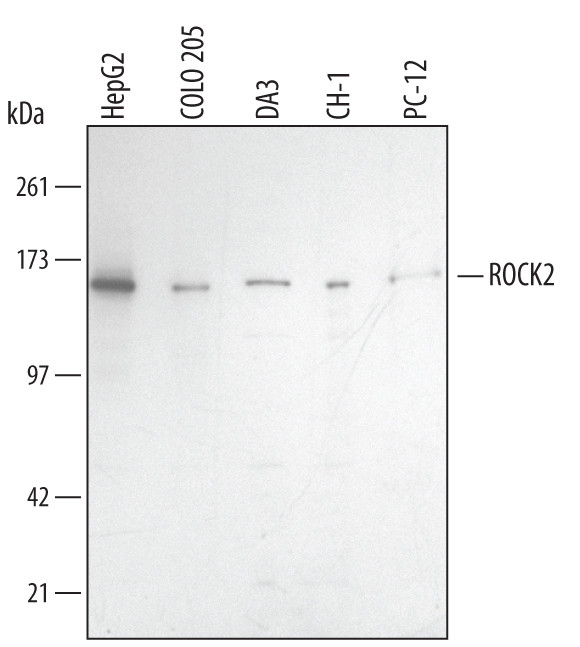 ROCK2 Antibody in Western Blot (WB)