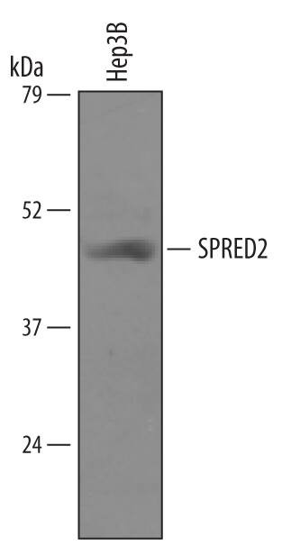 SPRED2 Antibody in Western Blot (WB)