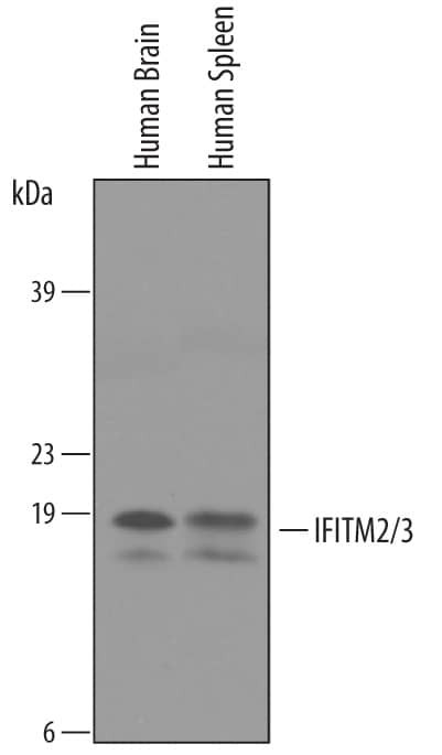 IFITM2/IFITM3 Antibody in Western Blot (WB)