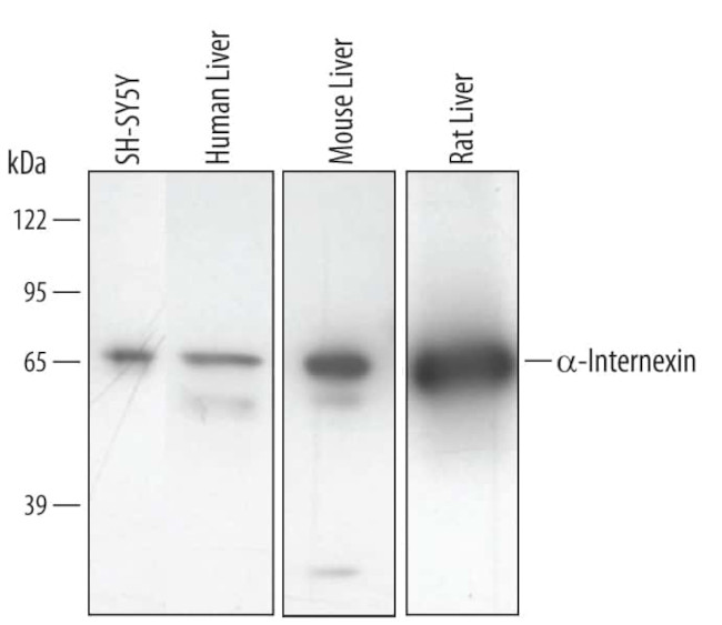 alpha Internexin Antibody in Western Blot (WB)