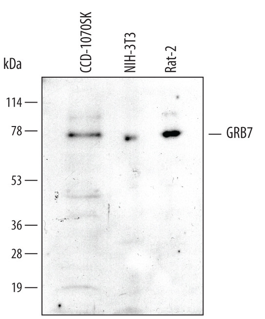 GRB7 Antibody in Western Blot (WB)