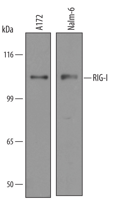 RIG-I Antibody in Western Blot (WB)