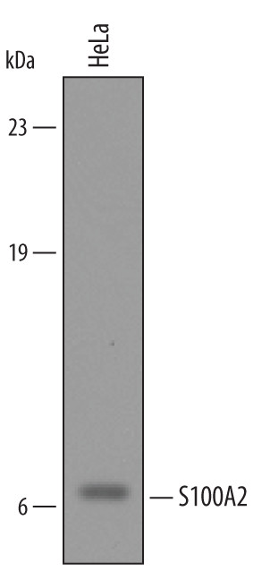 S100A2 Antibody in Western Blot (WB)