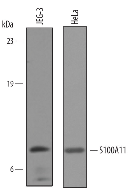 S100A11 Antibody in Western Blot (WB)